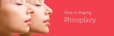 Rhinoplasty ( Cosmetic Nose job )